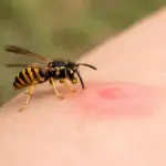 оса кусает человека